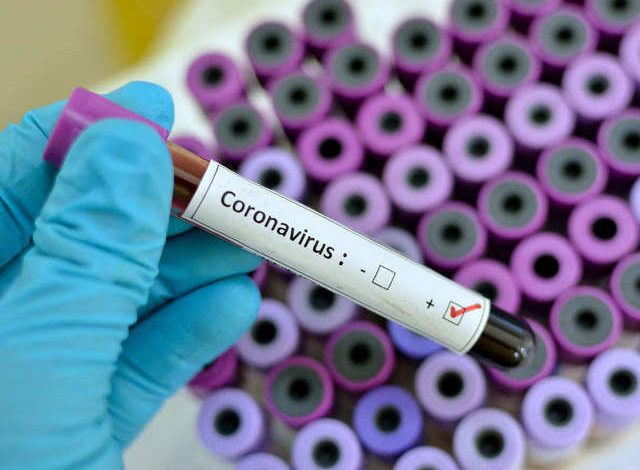 Coronavirus disease Update