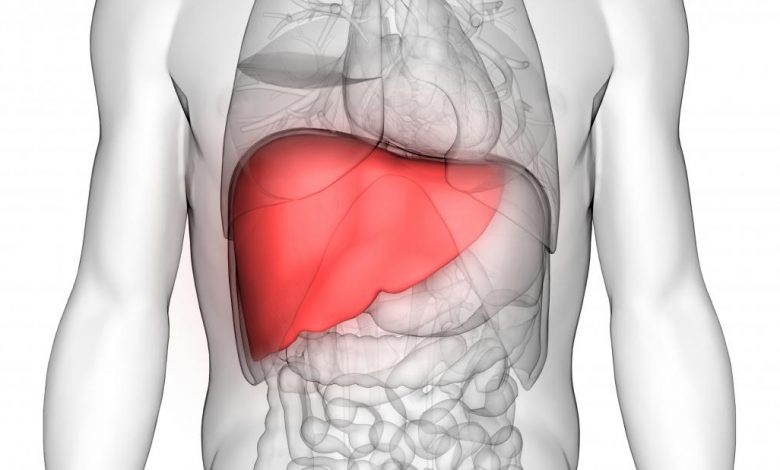 Liver transplant