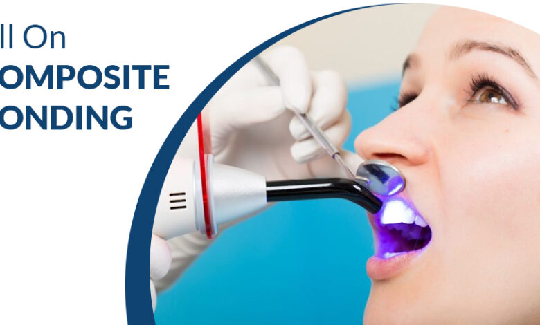 All on Composite Bonding - Dental Clinic London