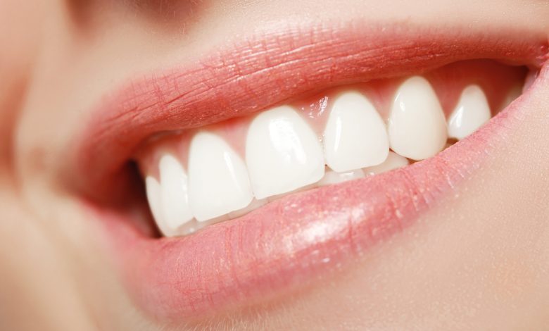 healthy teeth and gums