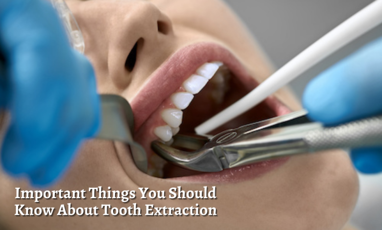 Tooth-Extraction