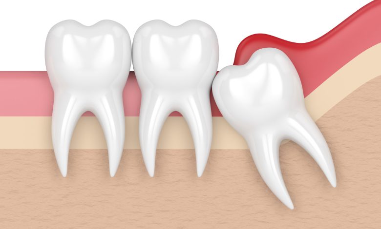 Dental Health